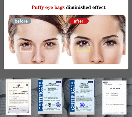 Electric Vibrating Hot Compress Eye Wand Dark Circle Remover Eliminate Eye Bags